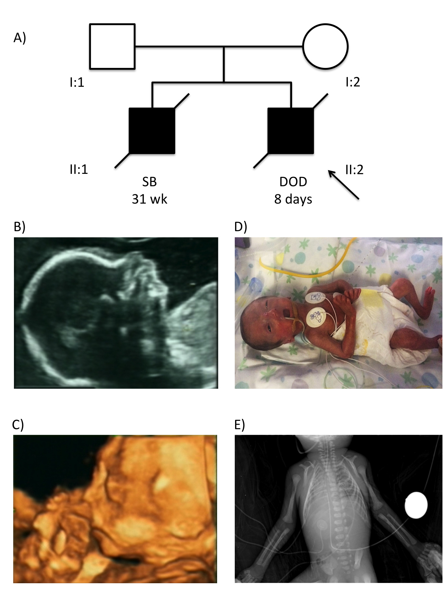 Clinical and genetic data of reported family