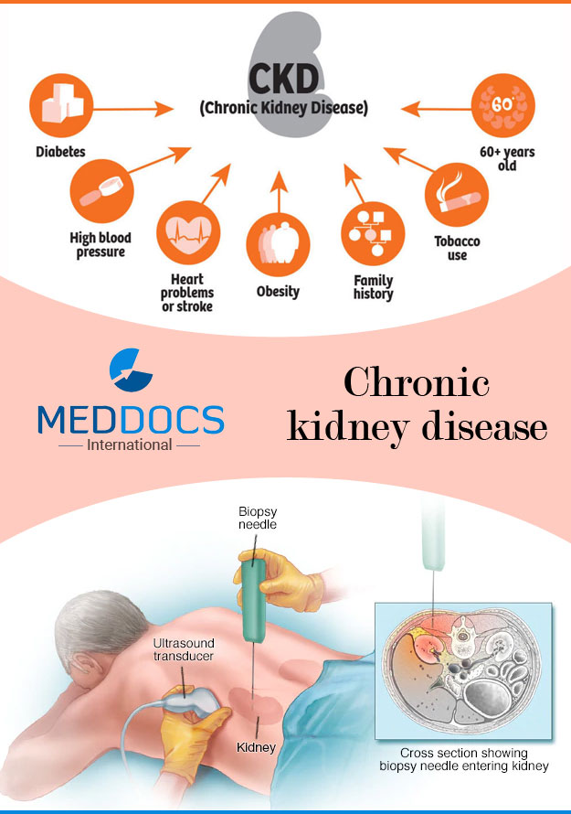 chronic-kidney-disease